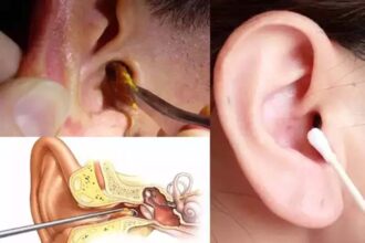 Home Remedies Ears