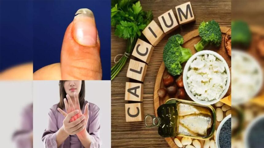 Calcium deficiency symptoms
