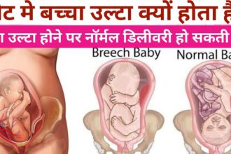 Breech Baby