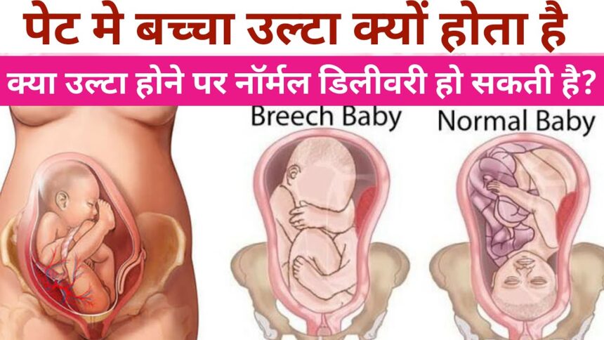 Breech Baby