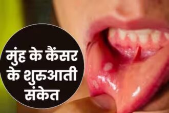 Early Sign of Mouth Cancer