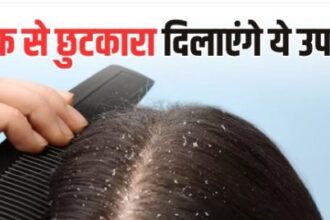 Dandruff Home Remedies