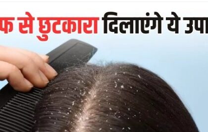 Dandruff Home Remedies